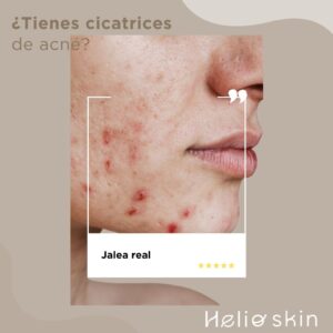 acne-y-jalea.alt